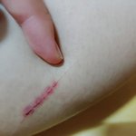 얘들아 이거 진짜 뭐하는 상처임??????