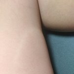 [드루와] 얘들아 나 모기한테 ㅈㄴ 크게 <b>물림</b>
