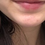 [조언부탁해] 진짜 인간적으로 나 턱<b>길이</b> 짧은편아니야..?