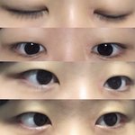 [드루와] +) 쌍수 나보다 잘 된사람 ㅋㅋㅋㅋ