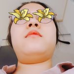 콧구멍 <b>축소</b>수술