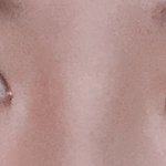 [조언부탁해] <b>나코</b>수술한거같아??