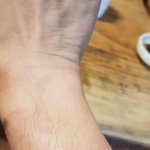 [봐주세요][<b>영상</b>]불필요한 경찰 <b>체포</b> 과잉진압으로 많이 다쳤어요