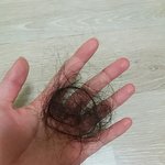 나 <b>탈모</b>맞지..?
