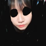 콧볼 축소 하고 싶은 사람 빨리 <b>하셈</b>