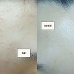<b>좁쌀</b>뾰록이로 항상 고민하는 분들 주목