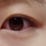 내 눈 <b>충혈</b>됐는데 어떡해 ㅜㅜㅜㅜㅜ