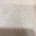 [19] 나 여잔데 <b>배털</b>이 이래 ㅠ