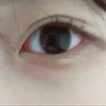 [댓글부탁해] 눈 <b>위에</b> 선 생기는거? 왜 이러는거야..??