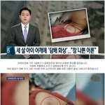 [댓글부탁해] 아파트에서 날아온 담배꽁초에 어깨 <b>화상</b> 입은 세 살...