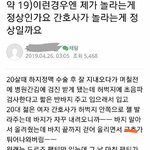 [19] 서로 놀란 <b>환자</b>와 간호사ㅋㅋㅋㅋㅋ