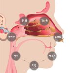 <b>비염</b>이랑 축농증 있는 사람들!!!!