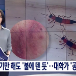 [모두드루와] 화상<b>벌레</b> 주의 ㅎㄷㄷ