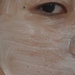 [댓글부탁해] 얘들아 피부 나만 이러니???