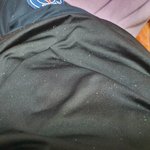 [조언부탁해] 맨날 머리감는데 <b>비듬</b>이 오져....(약혐?)