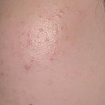 [댓글부탁해] 나같은피부인사람