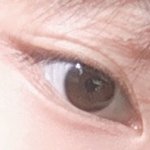 [댓글부탁해] <b>내</b> <b>눈</b> 앞트임하면 많이 이상할까??