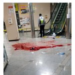 개인적으로 볼때마다 마음아픈 사건 (피 주의)
