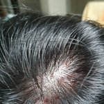 미용실에서 머리하고 저렇게됐는데 병원 안가도 되는건지 봐주세요