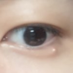 [댓글부탁해] 애<b>교살</b>에 여드름 남