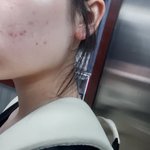 [댓글부탁해] ㅎㅏ아 얘들아 내피부<b>좀바</b>