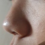 [댓글부탁해] <b>야들</b>아 피부에 난 거 이거 뭐야??ㅠ