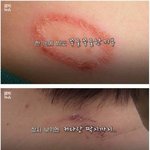 [모두드루와] 기숙사 침대까지 점령한 공포의 <b>화상</b>벌레