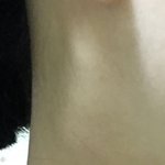 [댓글부탁해] <b>재업</b>) 이거 임파선염 맞아..? 사진ㅇ