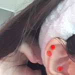 Ear ouch <b>spot</b>