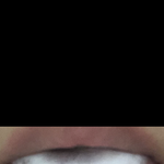 [댓글부탁해] 나보다 <b>백태</b> 심한사람 본적없음