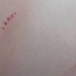 상처 가능서 <b>문의</b>