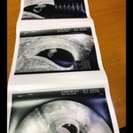 [모두드루와] <b>혼전</b>임신 발표한 전 티아라 멤버