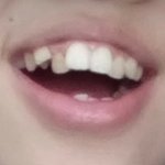 [드루와] 나 교정전후<b>오짐</b>ㅌㅌㅌ