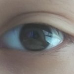 [댓글부탁해] 쌍수 할까 말까 (<b>사진o</b>)