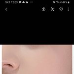 <b>저번</b>에 이런 피부글 어떻게 하냐는 글 아는애들없엉???