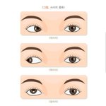 [모두드루와] 스마트폰 많이하면 생기는 <b>후천</b>적 사시