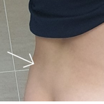 혹시 여기<b>부분</b> 살 왜튀어나오는지 아시는분??