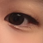 쌍수 할까 말까????
