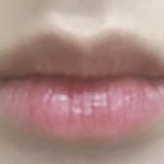 사진있음) 입술<b>필러</b> 맞을까 말까??