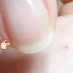 [댓글부탁해] 손톱 <b>투명</b>해지는 거 왜 그런지 아는 사람