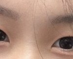 [댓글부탁해] <b>쌍수</b>투표해줘ㅠㅠ