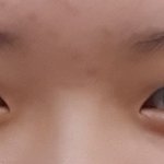 [드루와줘잉] 쌍수해라 말아라 조언좀
