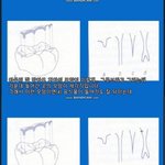 [댓글부탁해] <b>치아</b>는 타고나는 것이다.jpg