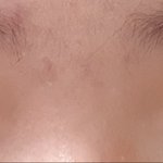 [댓글부탁해] 나 같은 눈은 눈 수술 할때 뭐해야하냐...