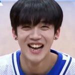 [프듀X] <b>요한</b>이는 왜 교정 안할까