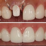 [프듀X] 송형준 <b>라미</b> 충격이다