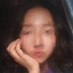 피부<b>톤</b>이 너무 어두운 사람은