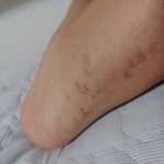 [댓글부탁해] 이거 흉진거 맞지 <b>족</b>같다