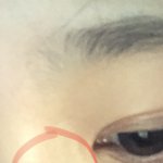 여기 <b>상처</b>있는데 ㅜㅠㅠ