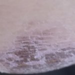 [<b>미방</b>] 아 딱지 개징그러워